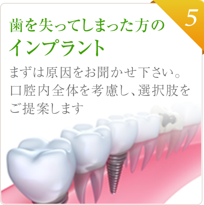 歯を失ってしまった方のインプラント まずは原因をお聞かせ下さい。口腔内全体を考慮し、選択肢をご提案します。